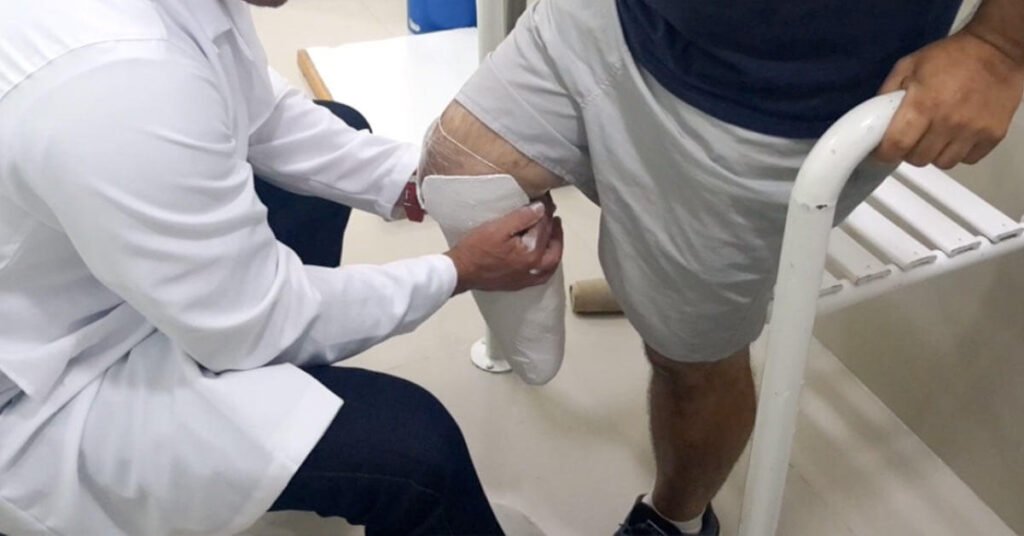 Tecnologia brasileira contra o diabetes: avanço promete reduzir amputações em 50%